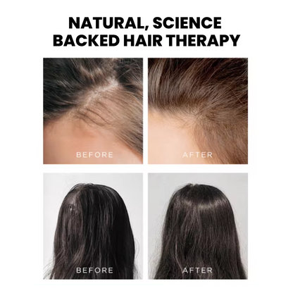 TheraBrush™ 4-in-1 Hair Therapy Rejuvenator